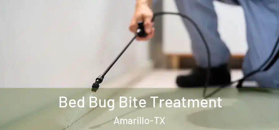  Bed Bug Bite Treatment Amarillo-TX